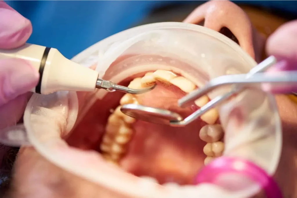 Imagenes: Clínicas Cleardent